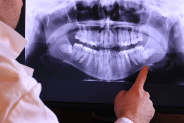 Best Emergency Tooth Extraction  in Hauser, ID